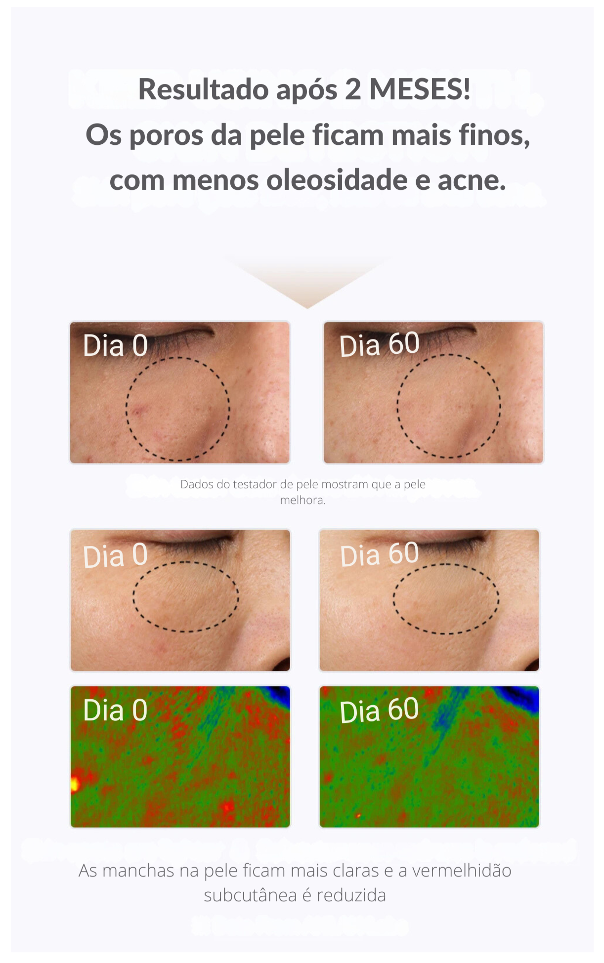 Mascara Essencial Glow Mask - Máscara LED para Tratamento Facial e Cuidados com a Pele